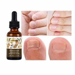 Ginger Nail Care Oil